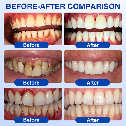 𝐆𝐥𝐢𝐦𝐦𝐞𝐫𝐥𝐲® 👀GumRevive periodontal repair gel💪