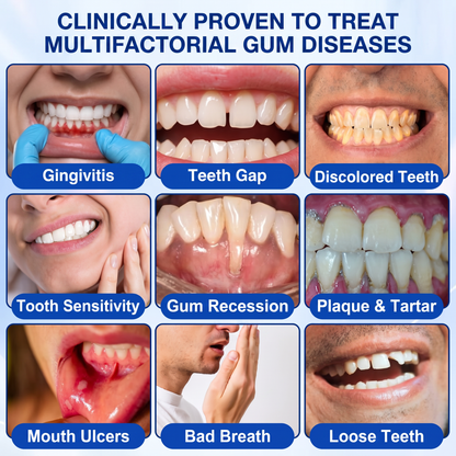 𝐆𝐥𝐢𝐦𝐦𝐞𝐫𝐥𝐲® 👀GumRevive periodontal repair gel💪