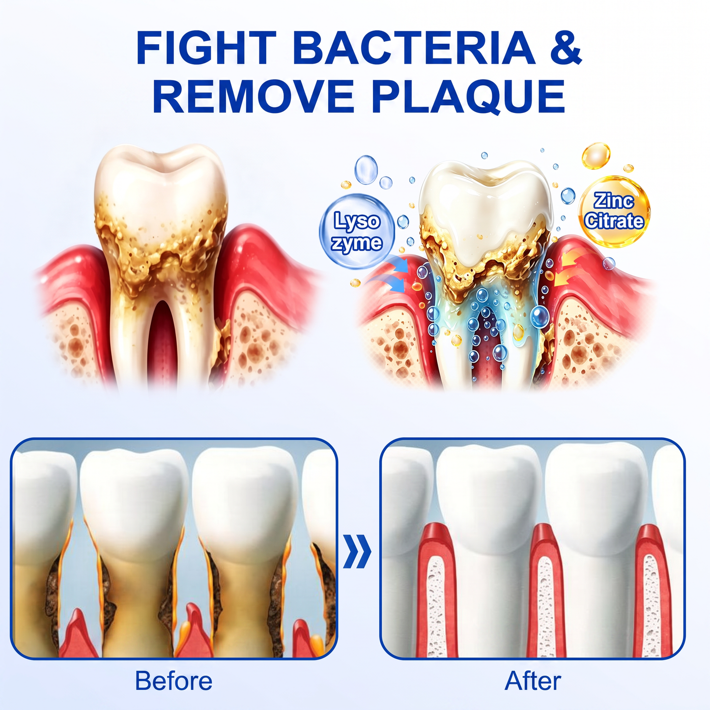 𝐆𝐥𝐢𝐦𝐦𝐞𝐫𝐥𝐲® 👀GumRevive periodontal repair gel💪