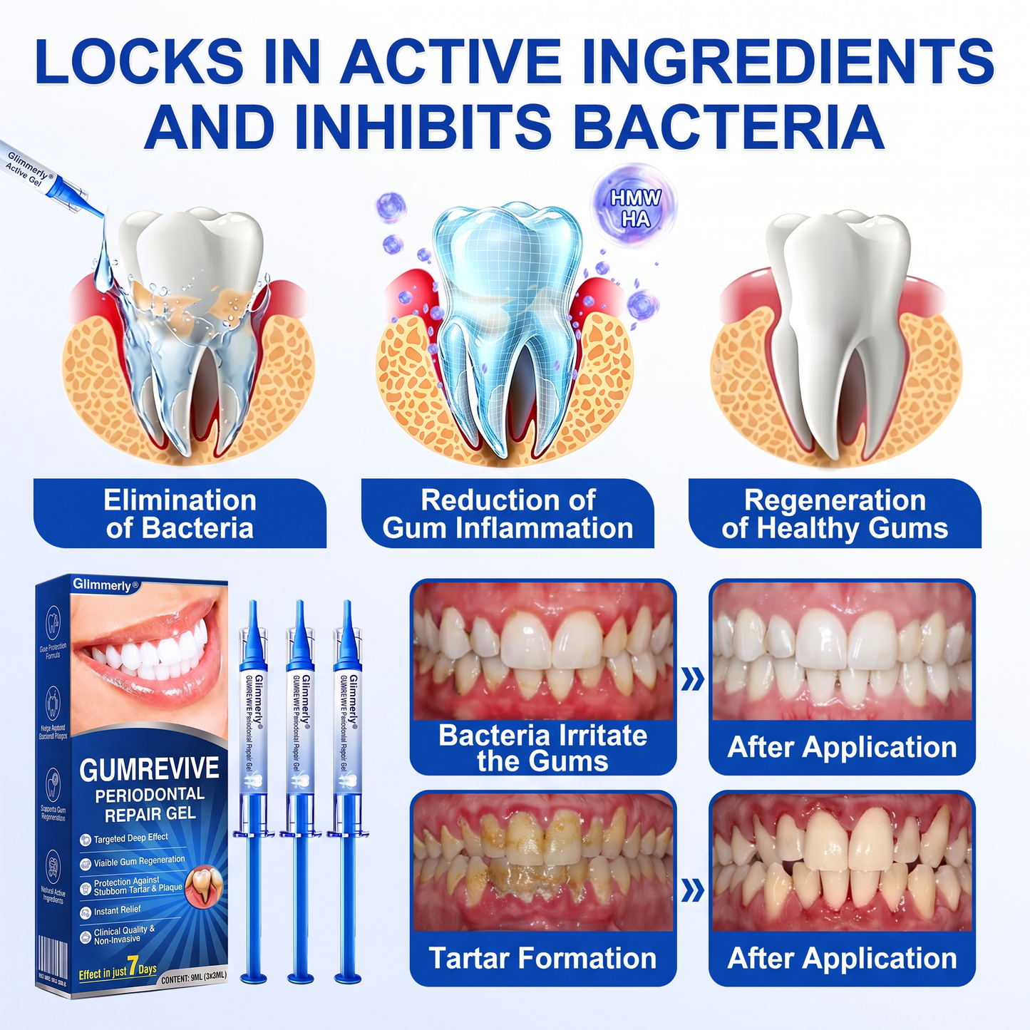 𝐆𝐥𝐢𝐦𝐦𝐞𝐫𝐥𝐲® 👀GumRevive periodontal repair gel💪