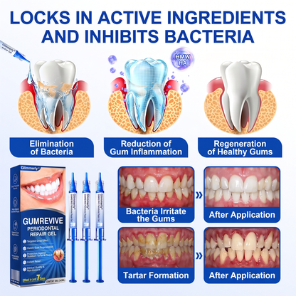 𝐆𝐥𝐢𝐦𝐦𝐞𝐫𝐥𝐲® 👀GumRevive periodontal repair gel💪